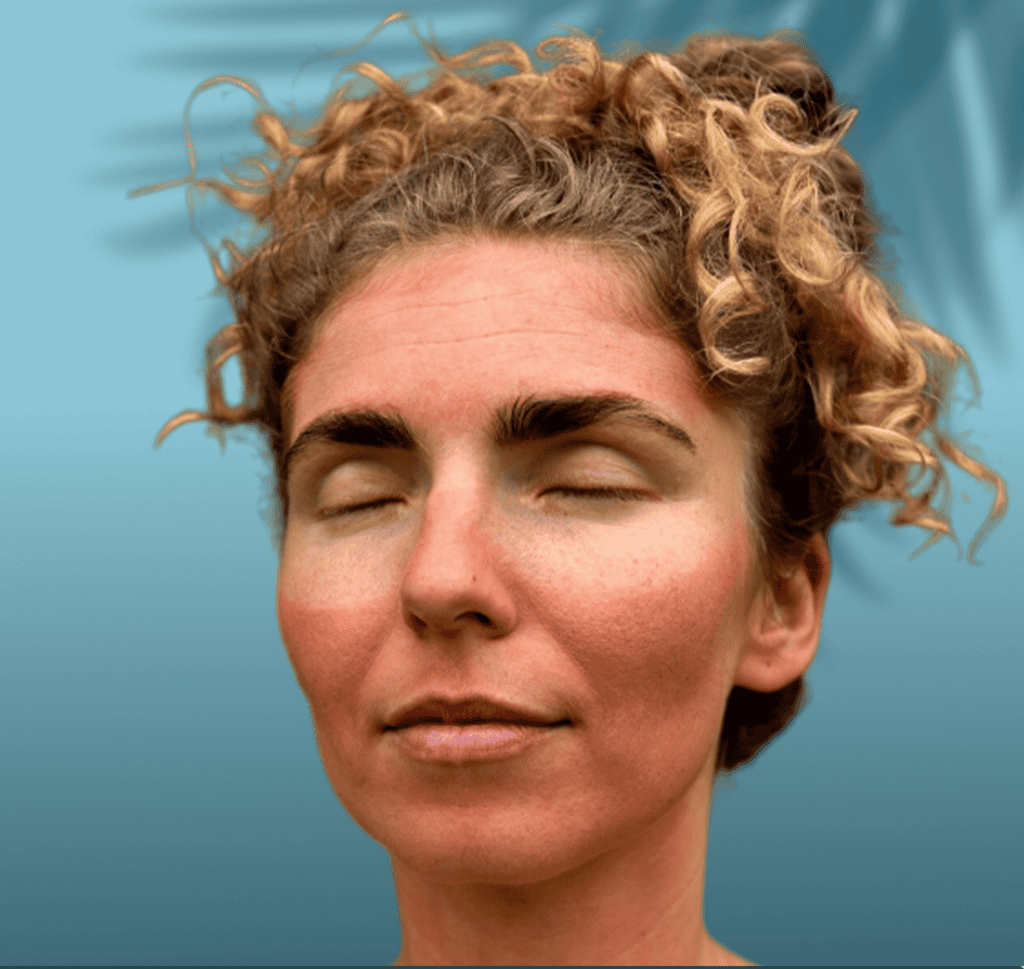 sun damage